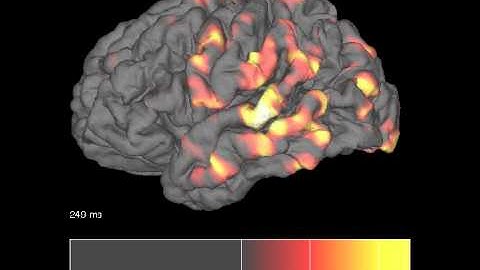 GPS: Cortical Activity, Pial Surface