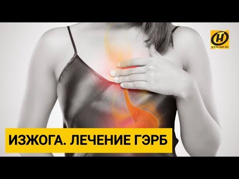 Как лечить ГЭРБ? Формула здоровья