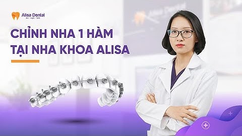 Niềng răng 1 hàm có được không, có hiệu quả như niềng cả 2 hàm không? | Nha khoa Alisa