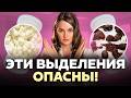 ТАКИЕ выделения НЕ НОРМА! Простые ПРАВИЛА безопасности, которые должна знать КАЖДАЯ!