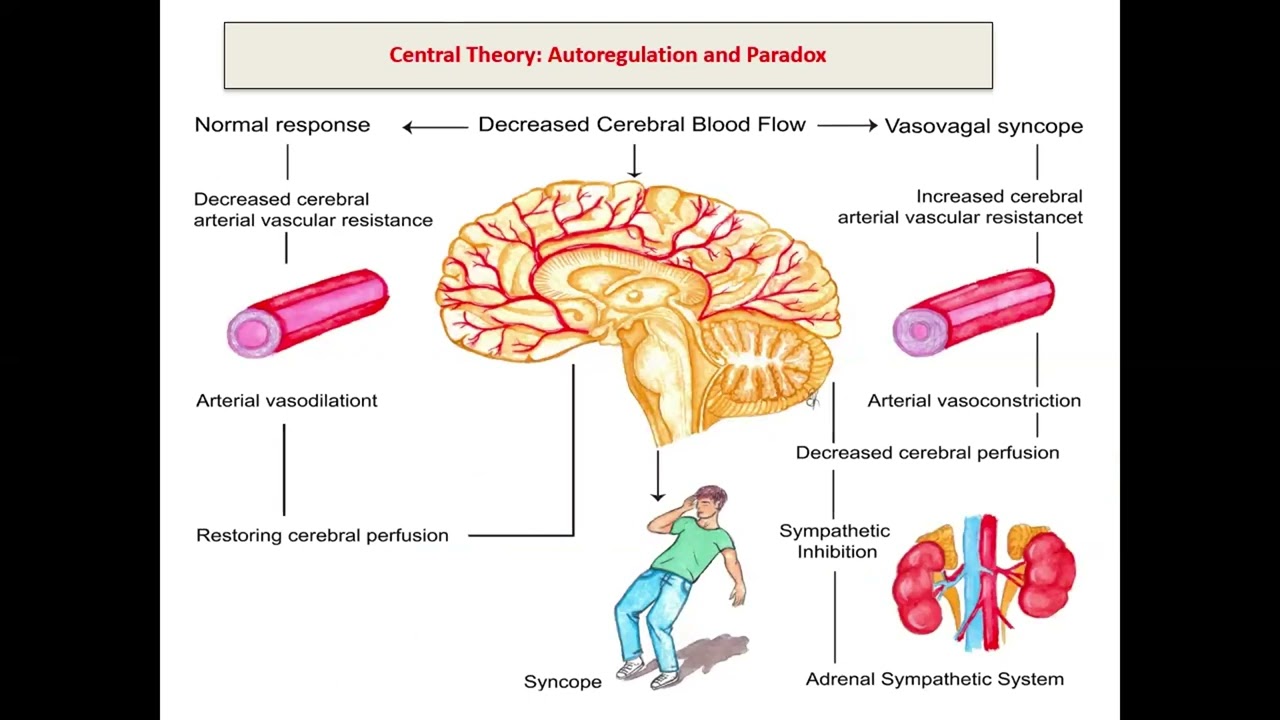 Dr  Eman Samir    Cardioinhibitory syncopemp4