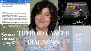 Thyroid Cancer Diagnosis Story at 23: My Second Cancer Diagnosis in my 20s