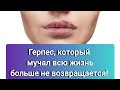 Герпес, который мучал всю жизнь больше не возвращается!