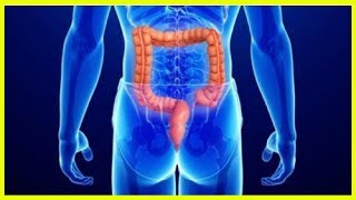 5 symptômes du cancer de l’anus, la maladie silencieuse que vous devez connaître