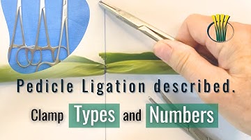 Pedicle Ligation described.