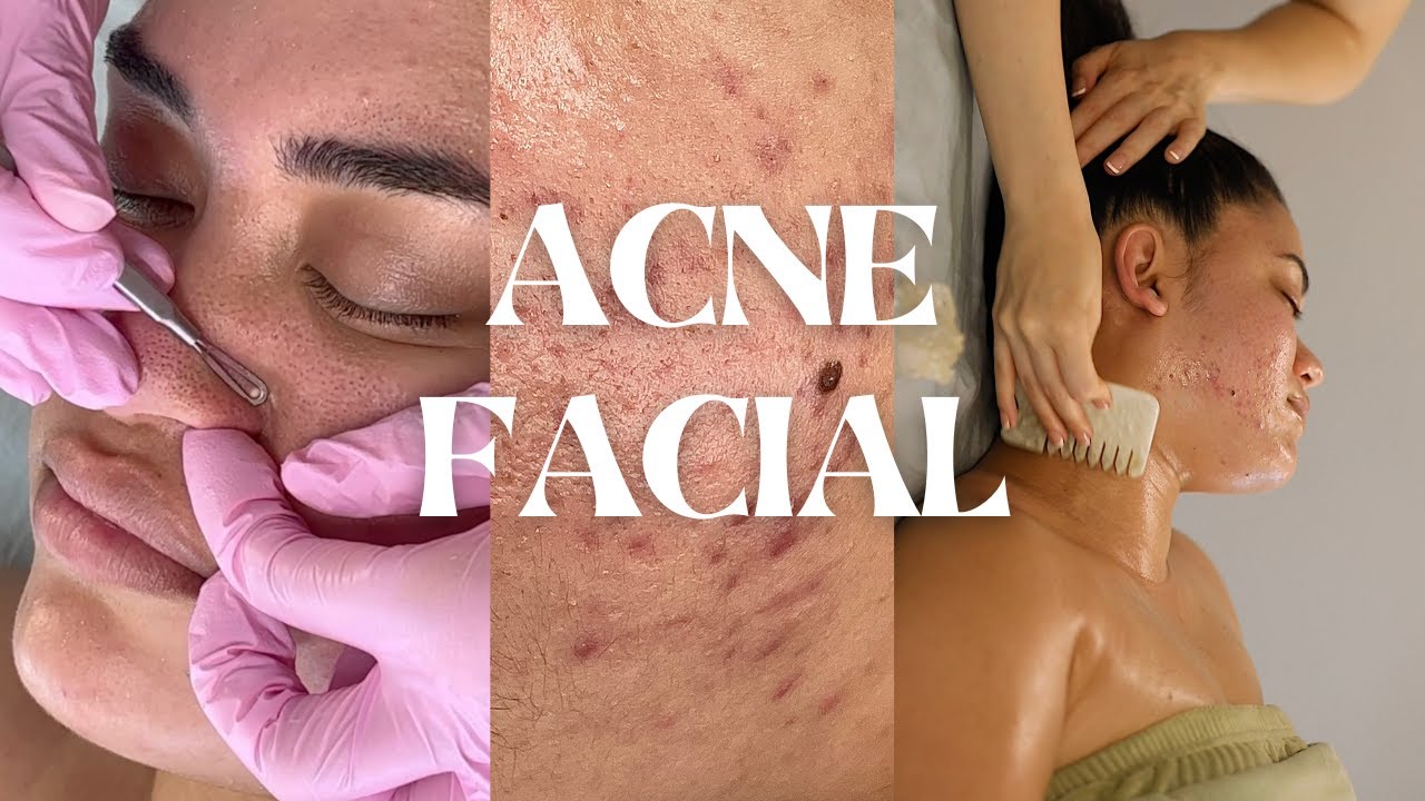 Purifying Acne Facial For Calming Pimples + Meditation Massage | Jadeywadey180