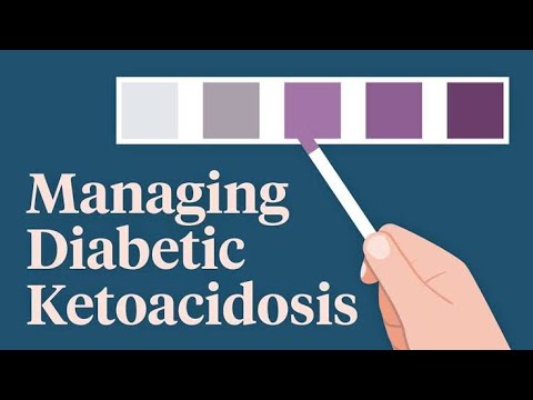 Management of Diabetic Ketoacidosis; 12 steps.