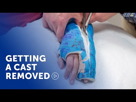 Having your cast removed at Boston Children’s Hospital