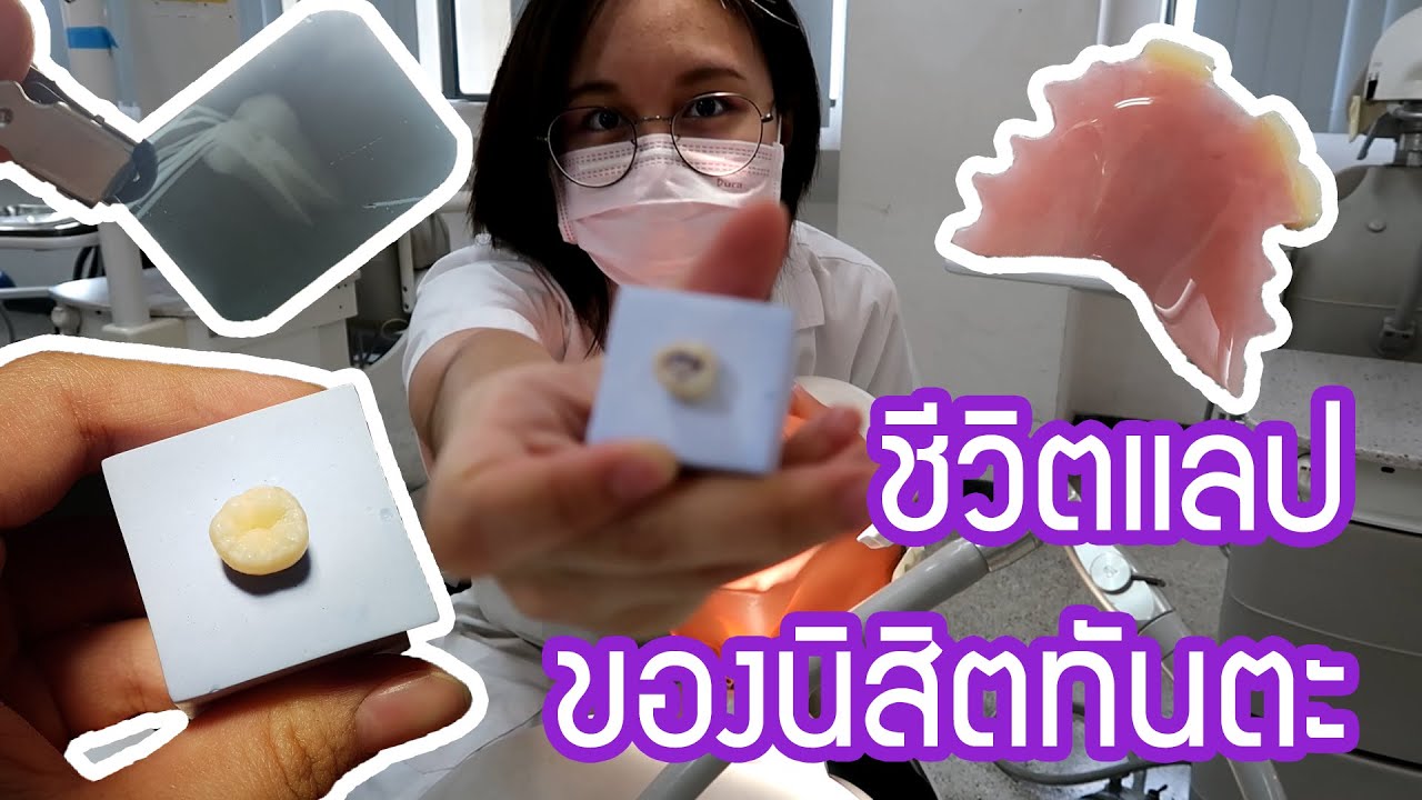ชีวิตแลปของนิสิตทันตะ (ขอบอกว่าสุด!!!) | Gain Supaphit