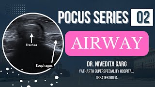 POCUS Airway: Revolutionizing Airway Management with Ultrasound  I Dr. Nivedita Garg