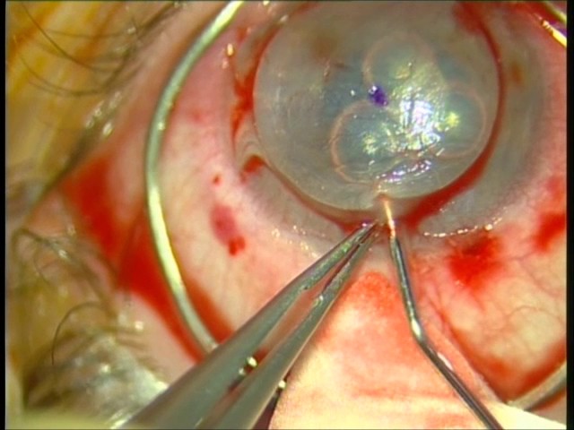 Fellowship Video Library