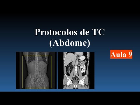 Curso de Tomografia - Aula 9 (Protocolo p/ Abdome)