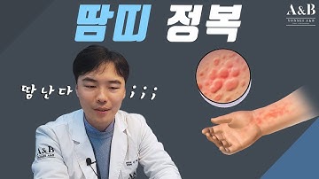 땀띠에 대한 우리의 대처자세 / 유아부터 성인까지 / 연세에이앤비피부과 이해진원장