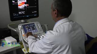 Ultrasonografia Doppler VASCULARĂ