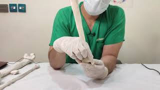 Tibia-Bony features