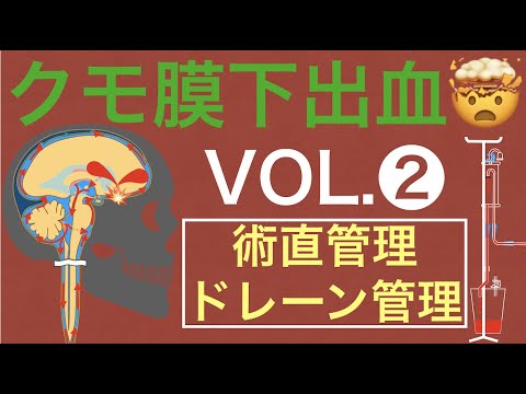 クモ膜下出血❷『術後管理とドレーン管理』