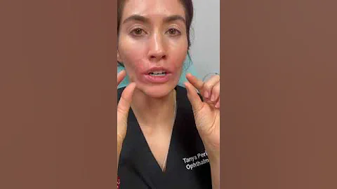 Morpheus8 treats pre jowls, skin laxity, and skin texture.