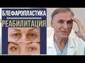 БЛЕФАРОПЛАСТИКА 🔥 РЕАБИЛИТАЦИЯ ВАЖНА ИЛИ НЕТ❓