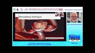An overview of WEB aneurysm treatment