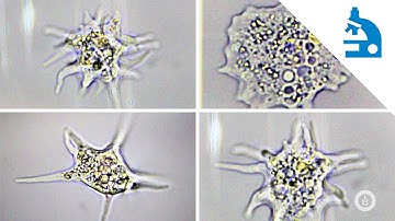 Algae Corner: "What Is It?" - Amazing Amoebas
