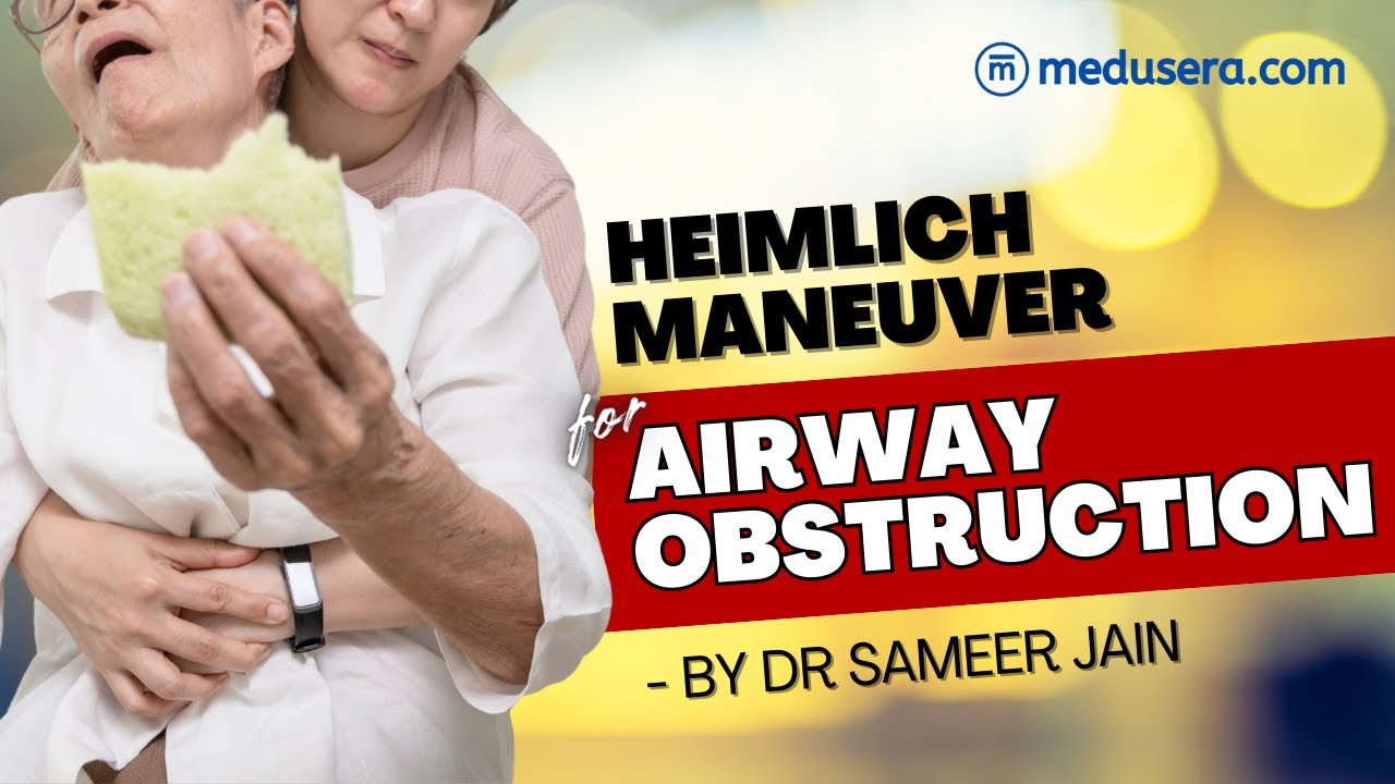 Heimlich maneuver for Airway Obstruction for 