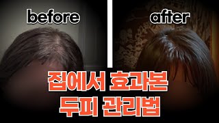 로즈마리오일의 신비한 효능