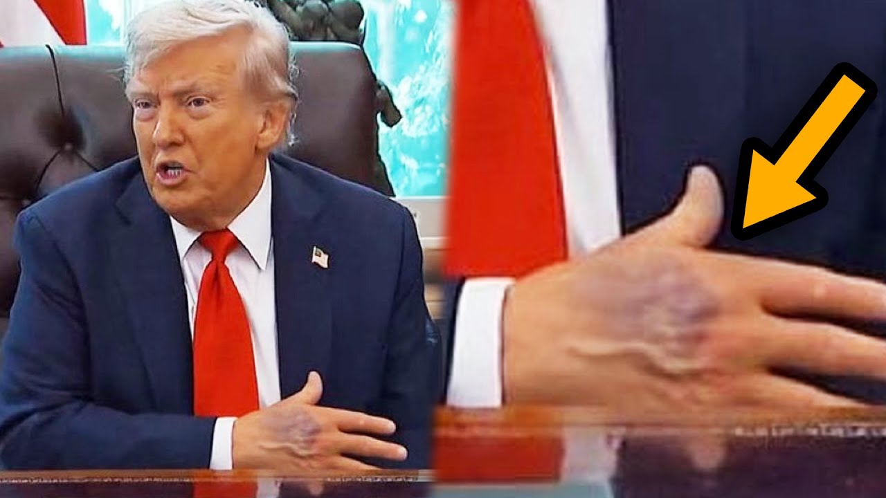 WTF: Trump’s hands CRUMBLING QUICKLY