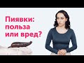 ПИЯВКИ в косметологии. Напрасно ли я их боюсь?