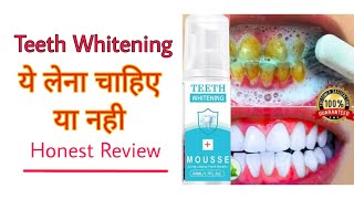 Teeth whitening || Mousse Teeth whitening || Teeth pain Solution || teeth cleaning