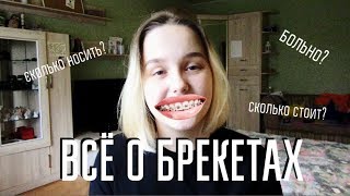 Вся Правда о Брекетах