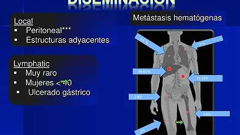 GIST: La Vision Del Radiologo