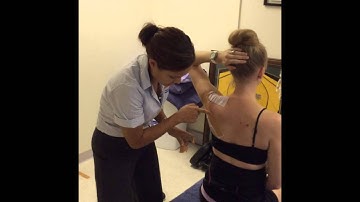 Upward rotation scapular taping