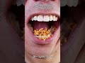 Satisfying Chewing ASMR #Compilation #ASMR #DoctorTristanPeh