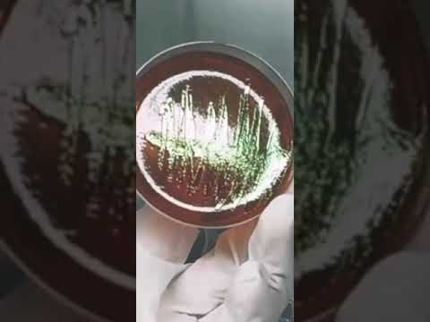 Videó: Növekszik a Bacillus subtilis MacConkey Agar-on?