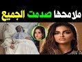 تغـير مـلامـح الفنانة حلا الترك كـلـيا بـعـد عمـلـية تجـميل .. لـن تصـدق كـيف اصبـحت مـلامـحها !!