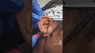 Earwax Removal You Wont Believe