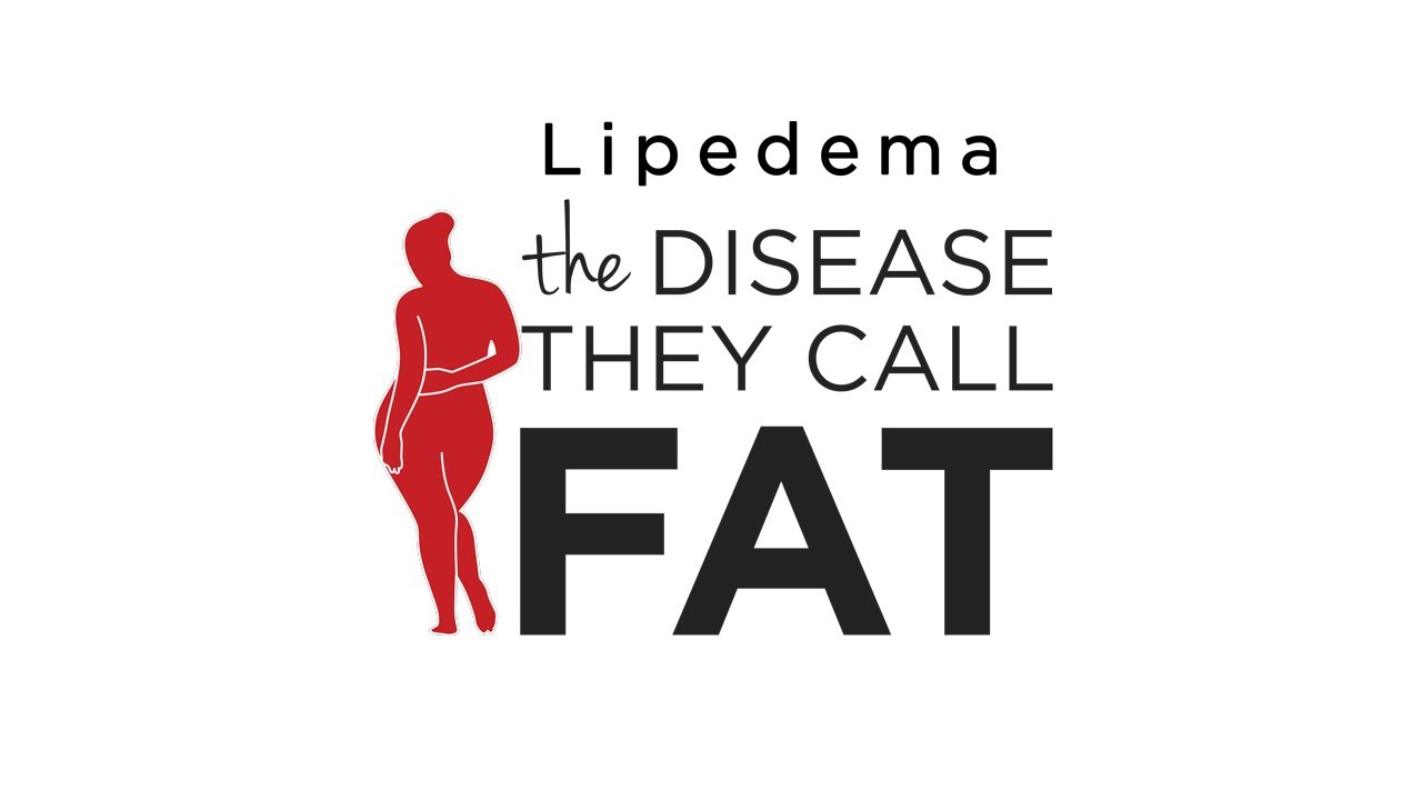 What is Lipedema? The Disease They Call FAT 