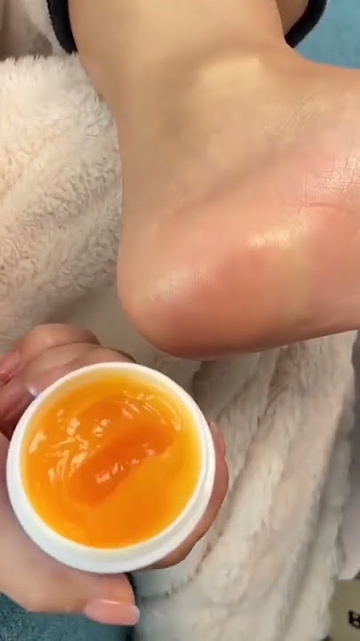 Make your feet soft and beautiful with this cream | Anti crack foot cream #footcream #shorts