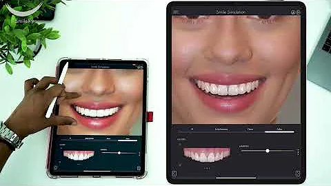 Master Smile Design with AI Simulation