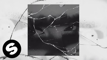 SLVR - Under Pressure (Official Music Video)