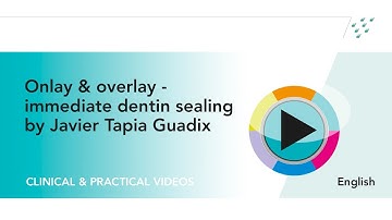 Onlay & overlay - immediate dentin sealing by Javier Tapia Guadix