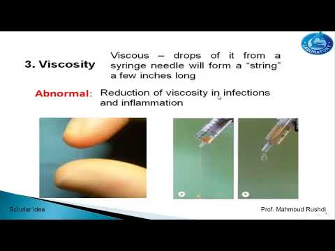 Analysis of the synovial fluid (Joint Fluid)