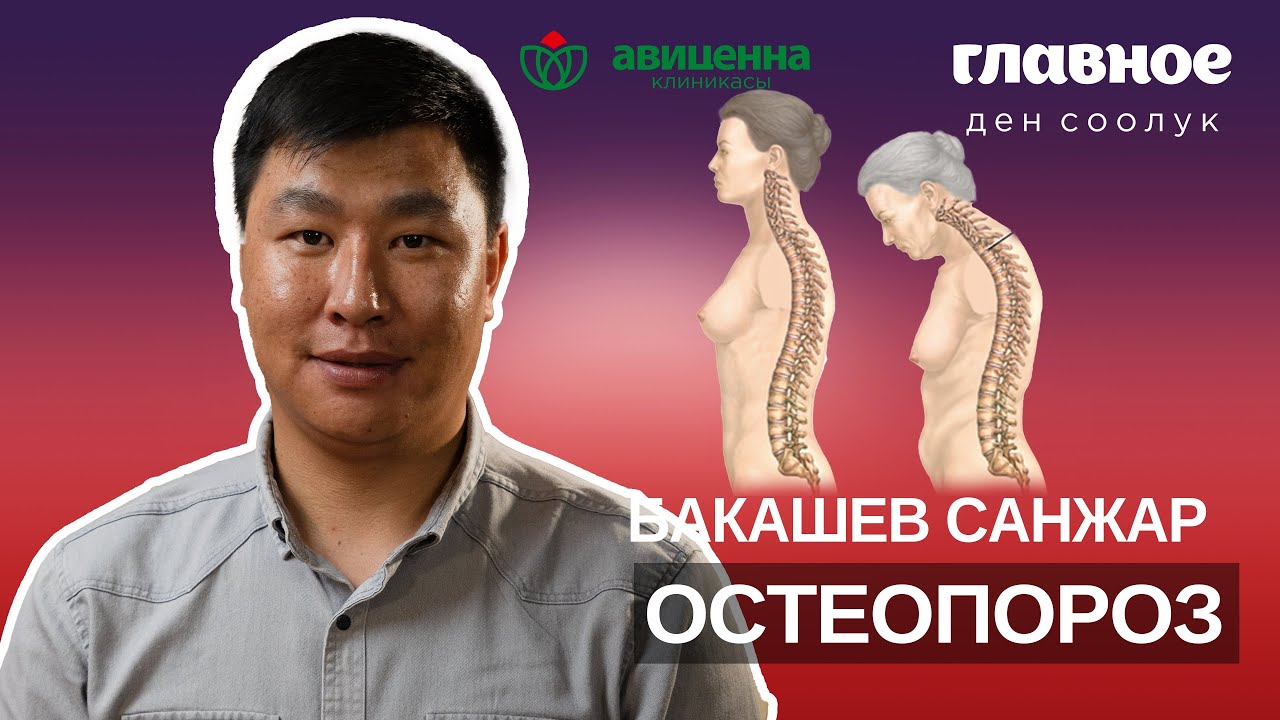 Остеопороздун кесепеттери жана даарылоо ыкмалары.