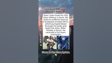 He Lived 555 Days Without a Human Heart ❤️