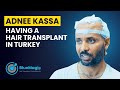 Bluemagic group international  adnee kassa having a hair transplant in turkey