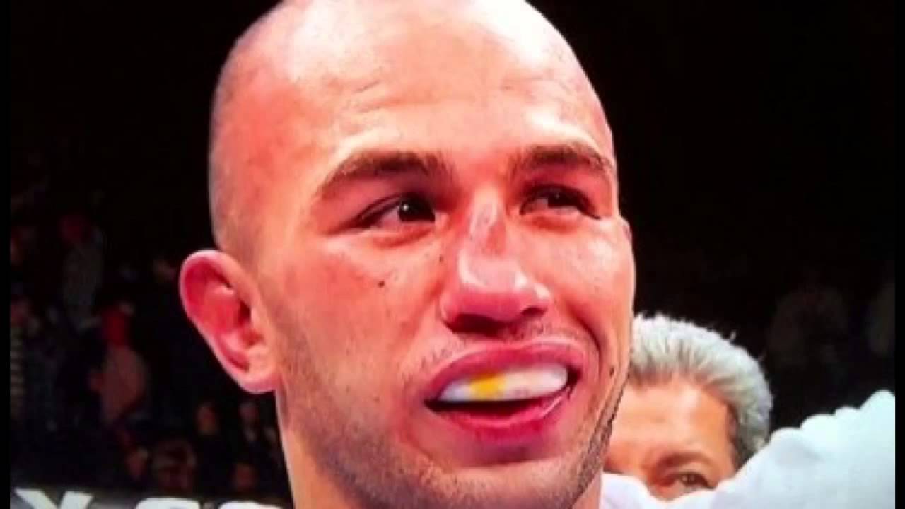 FRACTURAS DE HUESOS NASALES, TRATAMIENTO PAA FRACTURAS NASALES ...