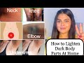 Naturally Lighten & Brighten Dark Underarms, Knee, Elbow,  Neck & Pubic Area || Get Smooth Skin ||