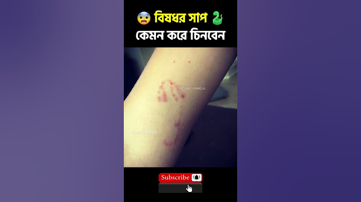 বিষাক্ত সাপ কামড়ালে তা বোঝার উপায় | Amazing Facts #shorts