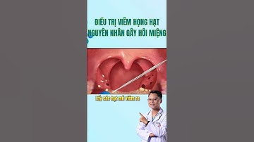Cách điều trị Hôi Miệng do viêm họng hạt #drcuong #shorts #saurang