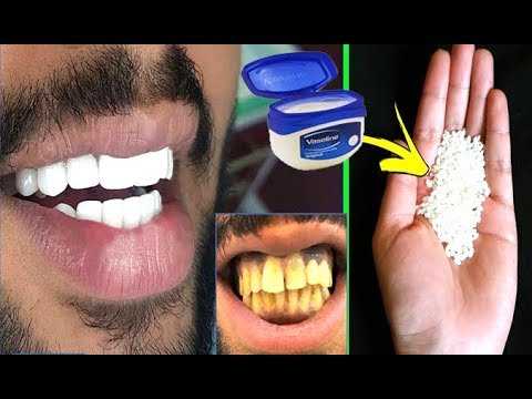 In Just 2 Minutes, Turn Yellow Teeth To Pearl White and Shine, Teeth Whiten at Home everyday culture